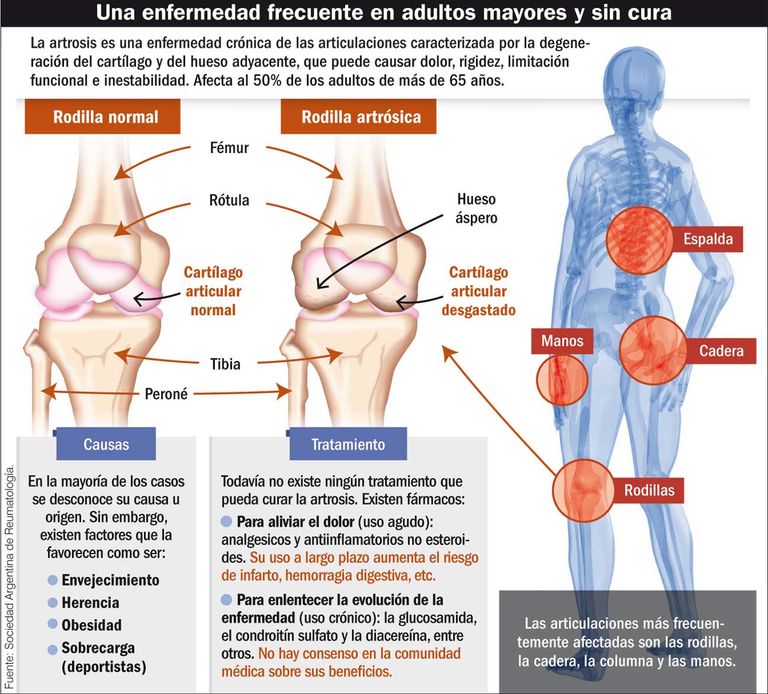 artrosis infografia 20200124