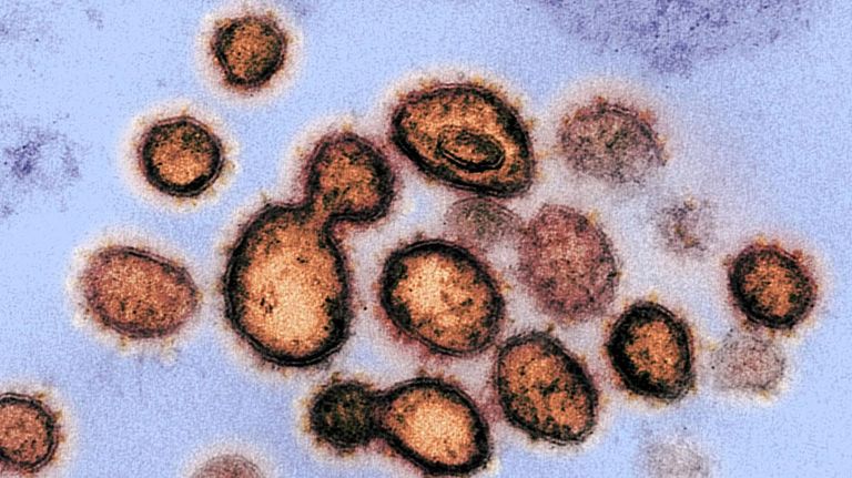 VIRUS 20220125