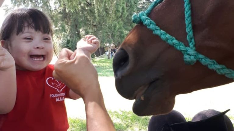 sindrome de down 3 03212019