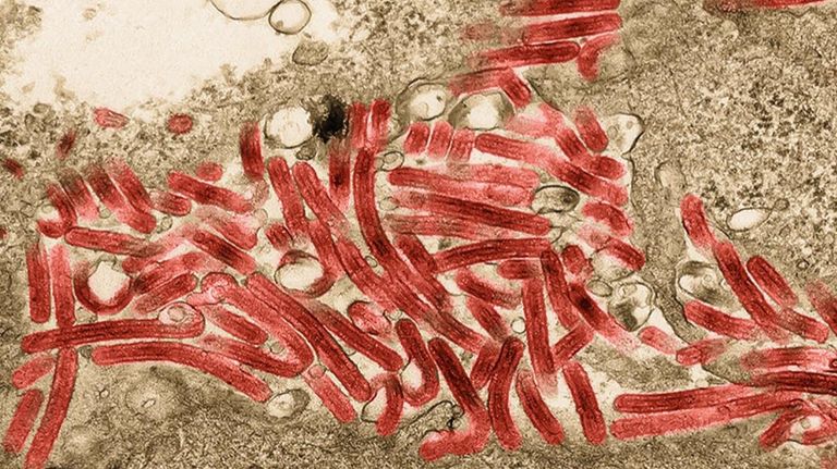 virus Marburgo 20210811