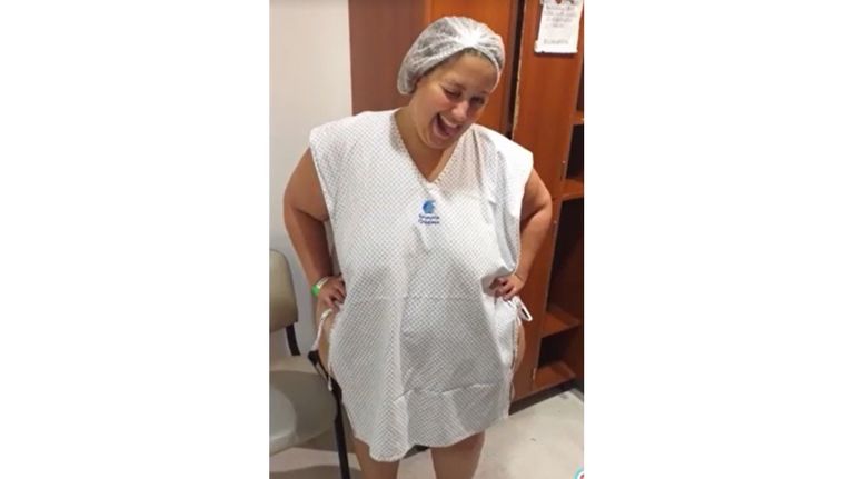 Antes y después