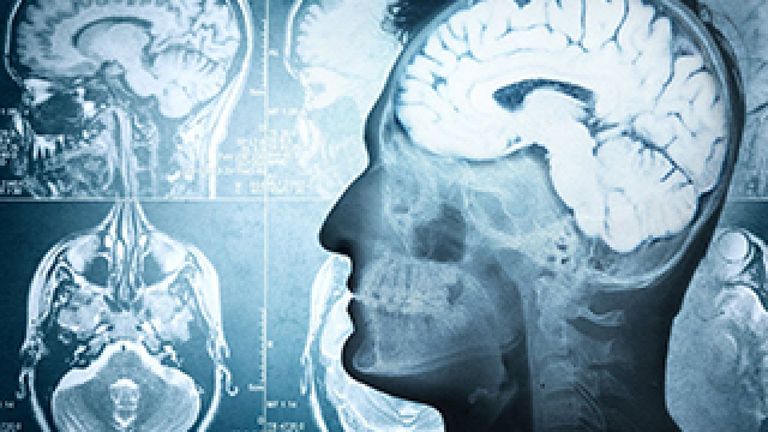El cerebro humano