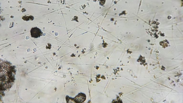 Microplásticos