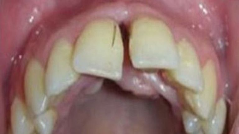 pelos dientes 06022020