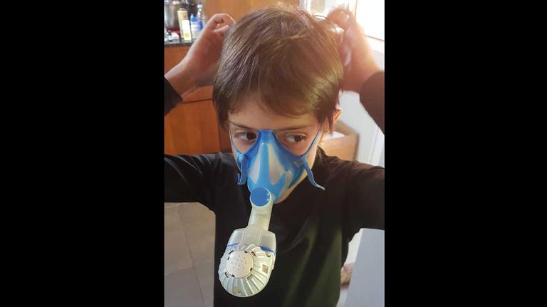 Fibrosis quística. 20200811
