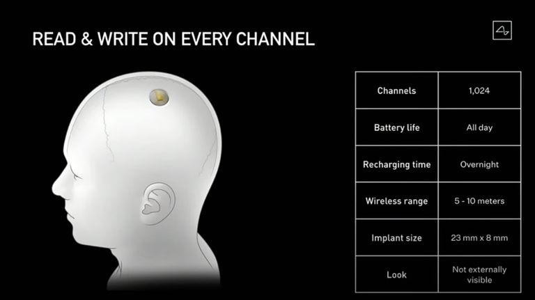 Neuralink, el nuevo proyecto de Elon Musk.