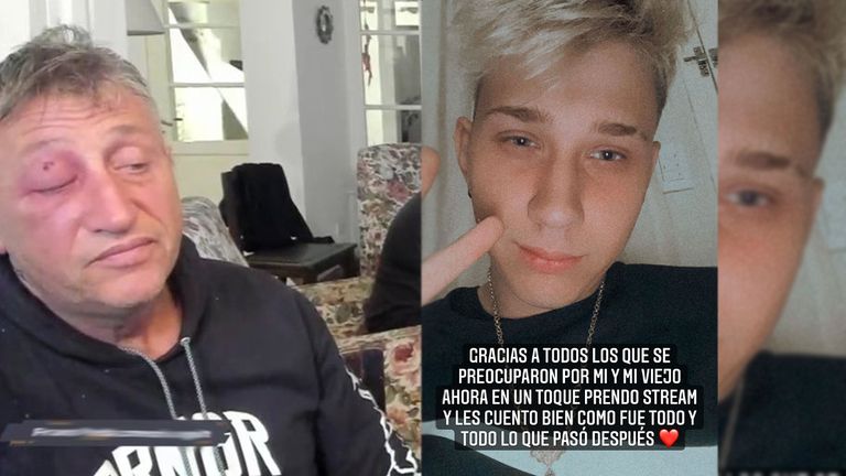 Le pegaron al padre de Brunenger en vivo en stream
