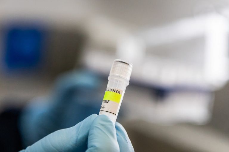 Hantavirus_investigación