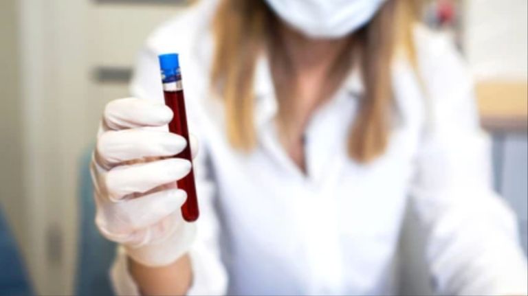 Biopsia líquida