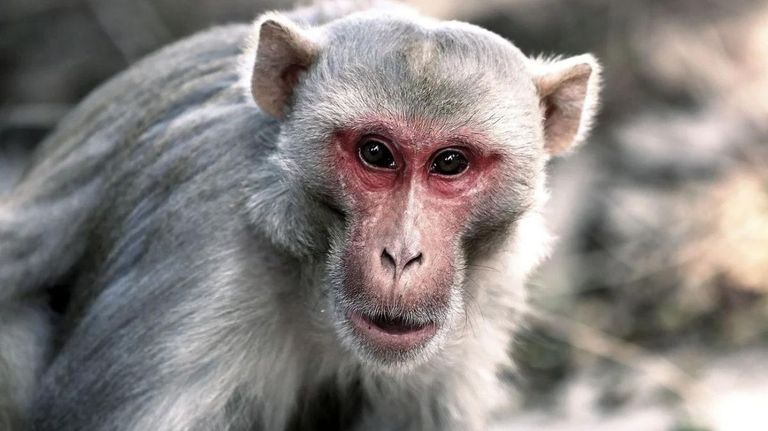 viruela monkeypox