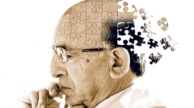 alzheimer 09212018