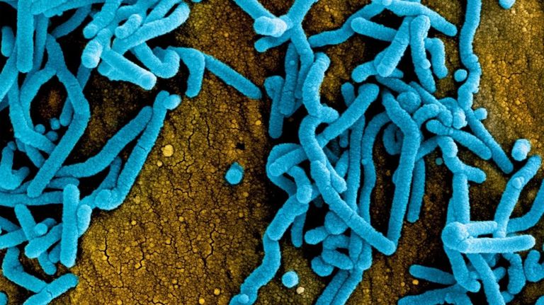 virus de Marburgo