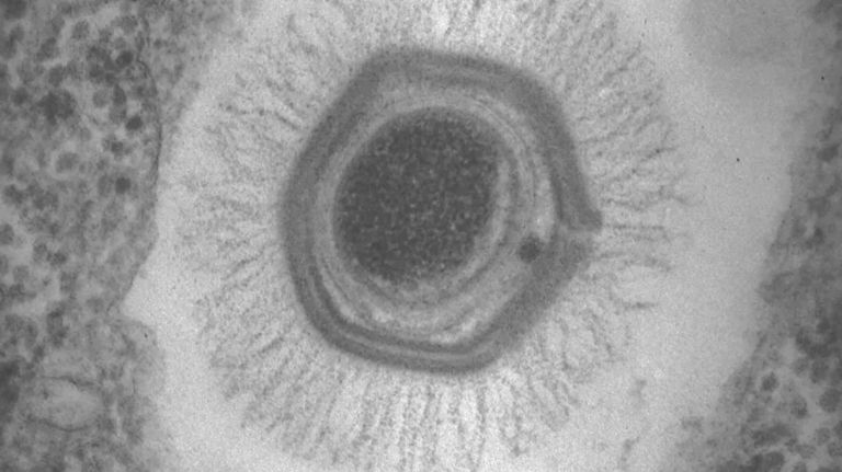 mimivirus