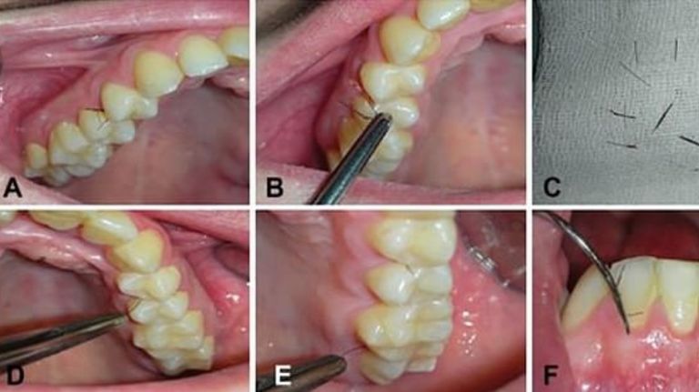 dientes pelos 06022020