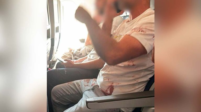 Imágenes aterradoras del incidente