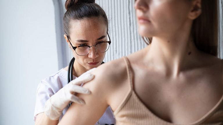 Dermatitis atópica