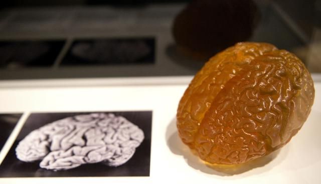 Cerebro de Einstein