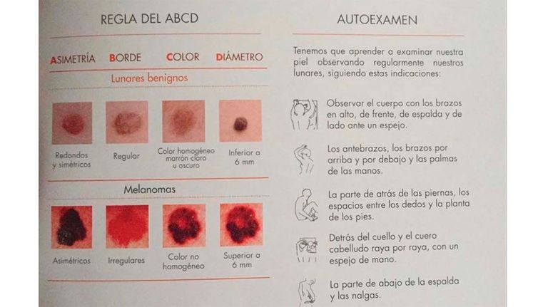 cancer-de-piel-20112018
