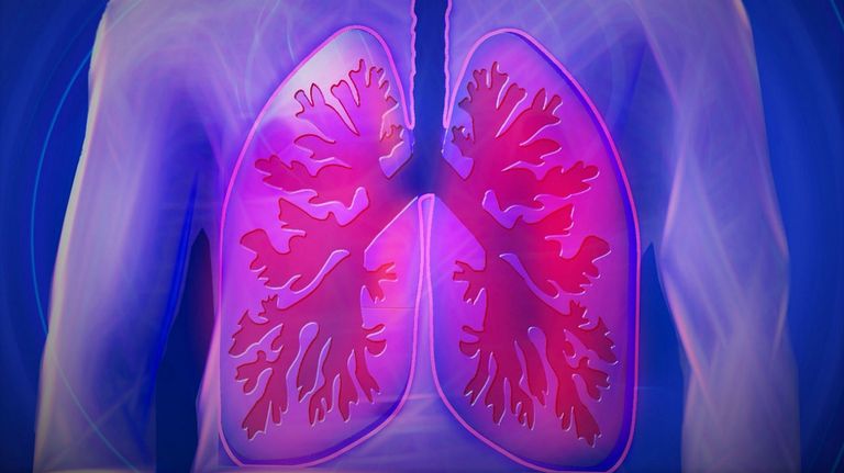Pulmones y EPOC.