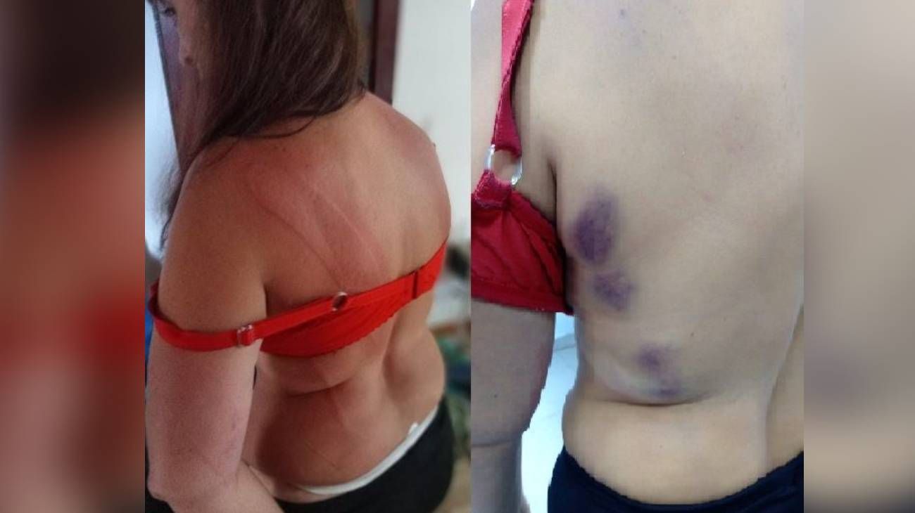 "Necesito ayuda, vivo con miedo": una madre denunció 10 veces a su hijo por violencia de género