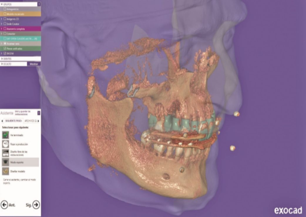 Dr. Marcelo Pérez: odontología digital, a su alcance