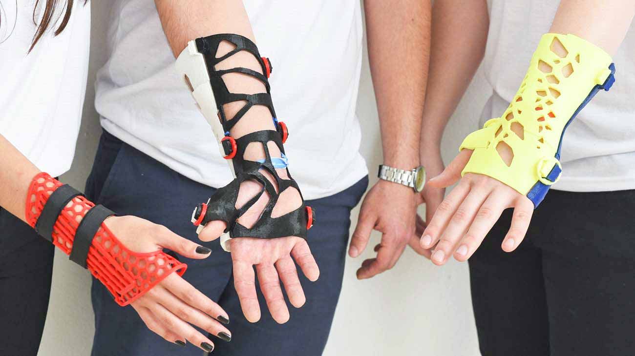Alumnos crearon férulas reusables impresas en 3D para tratar lesiones