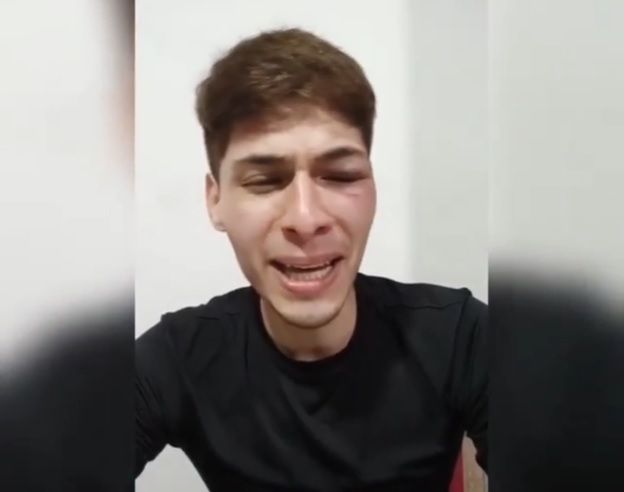 Joven no binario con síndrome de asperger denunció un ataque homofóbico en La Plata
