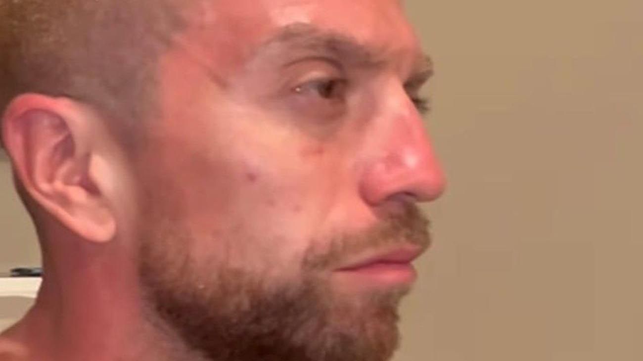 Alejandro “Papu” Gómez compartió las secuelas que le quedaron tras la caravana de festejos