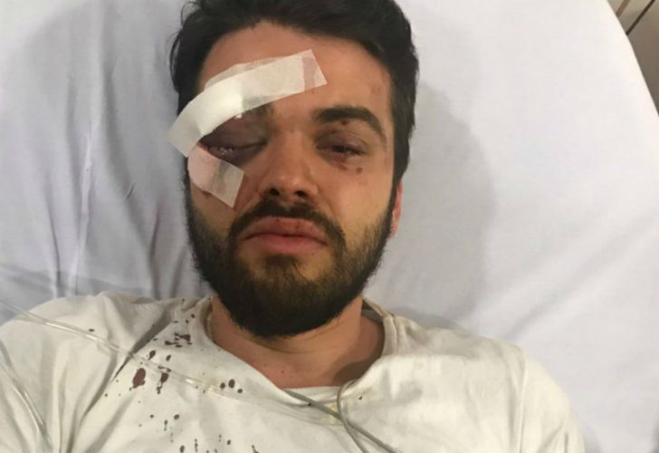 Lo golpearon por ser gay y envió un emotivo mensaje de lucha