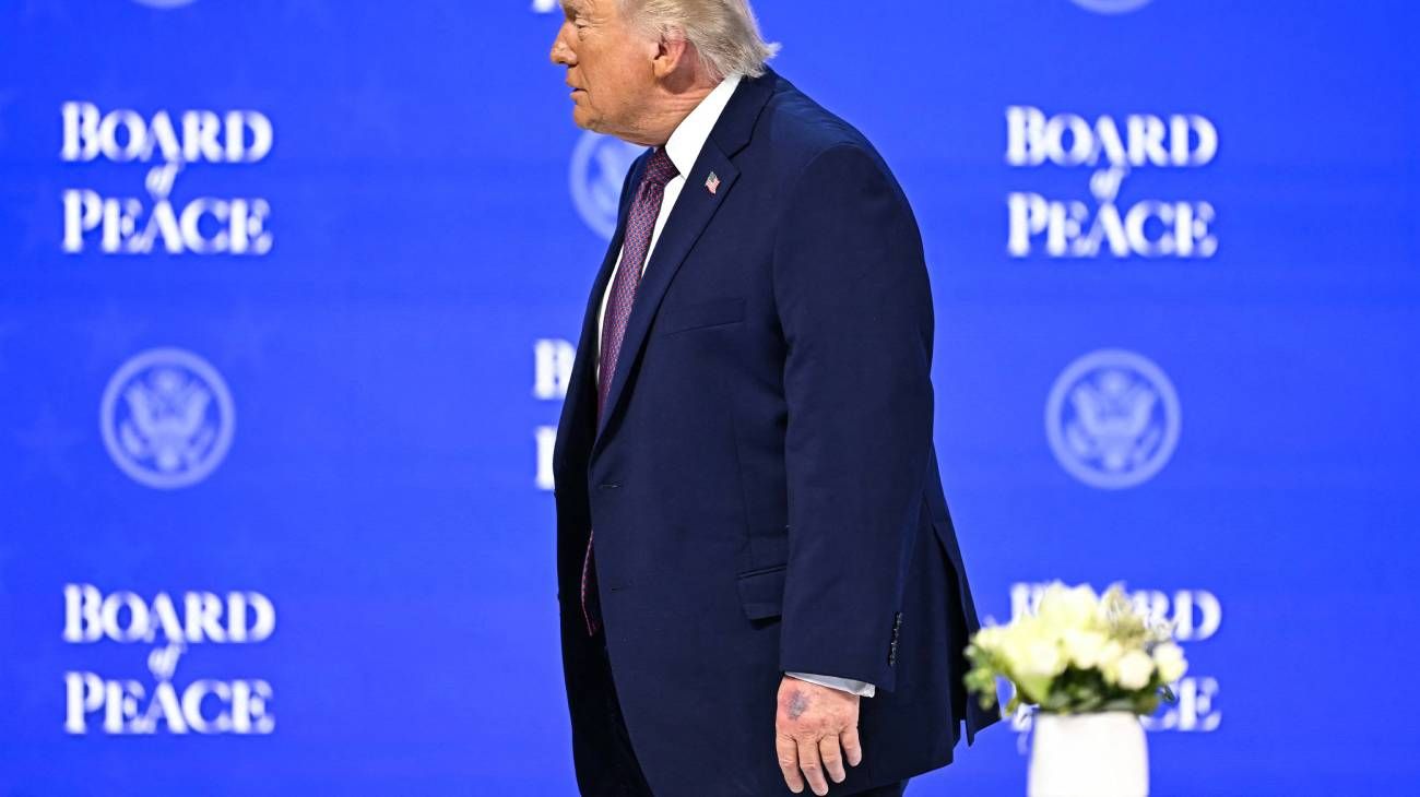 Aspirinas, maquillaje y versiones cruzadas: el misterio de los nuevos moretones de Donald Trump