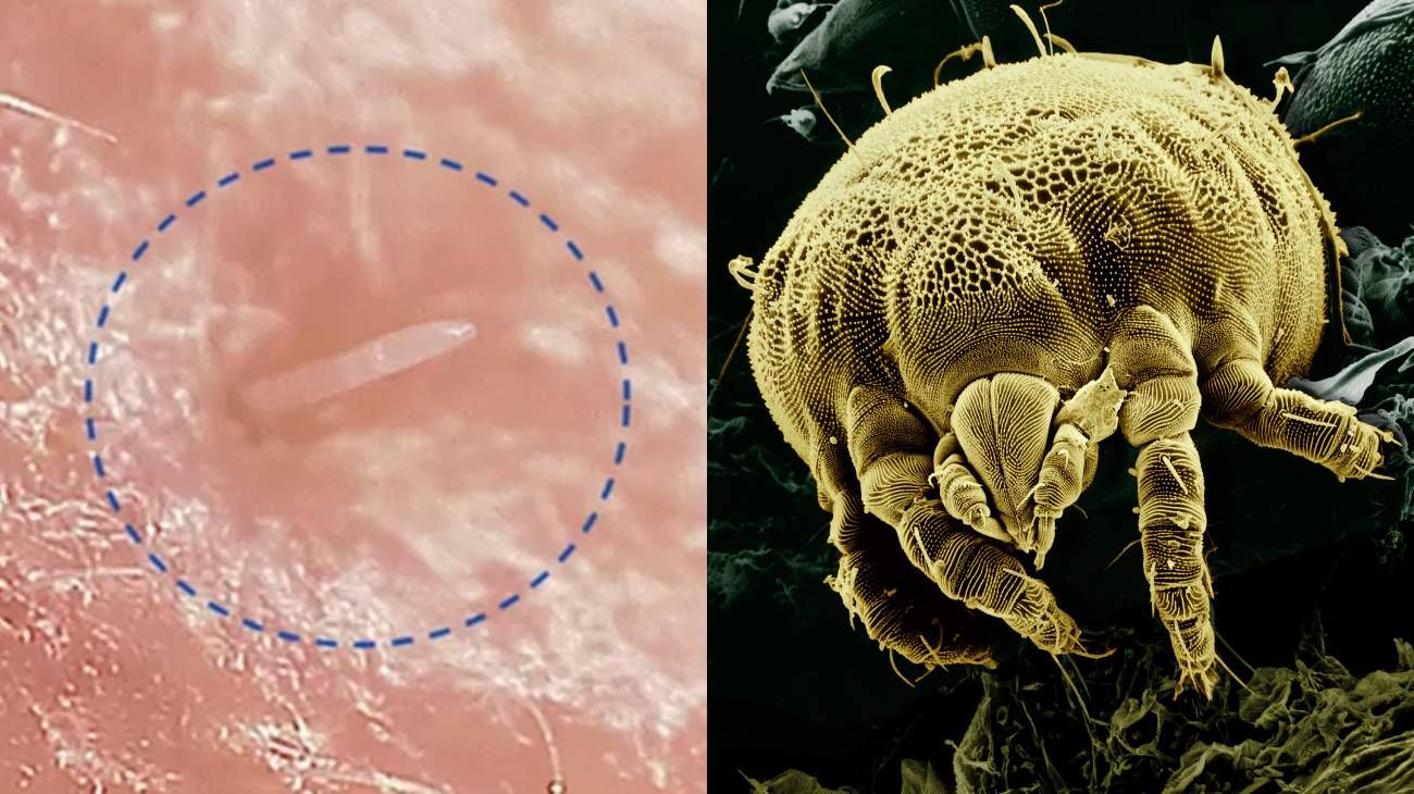 Lo confirmó la ciencia: los ácaros tienen sexo en la superficie del rostro humano