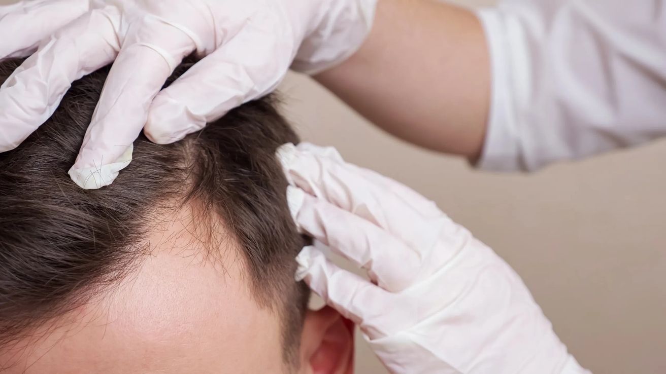 Descubren una molécula que hace crecer el pelo