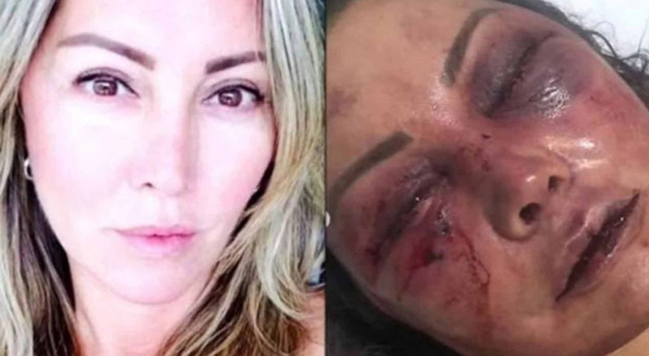 Lo conoció por redes sociales y la sometió con golpes, mordiscos e insultos