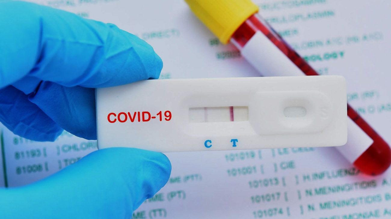 Suiza distribuye gratuitamente auto-tests rápidos para detectar el COVID-19