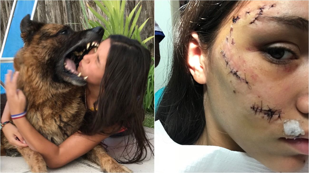 Jugaba con su perro en la pileta y el animal le desfiguró la cara