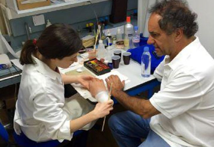 Rabolini mostró cómo Scioli "pone a punto su nuevo brazo"