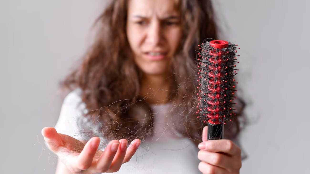 Los estigmas con los que carga la alopecia