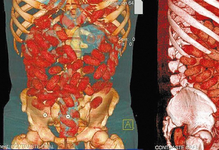 Detectan ‘mulas’ con cocaína líquida y la mayoría de ellas son argentinas
