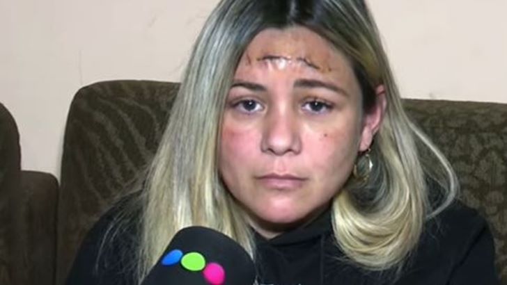 Córdoba: le dispararon en la cabeza, sobrevivió, pero tuvo que irse de su casa