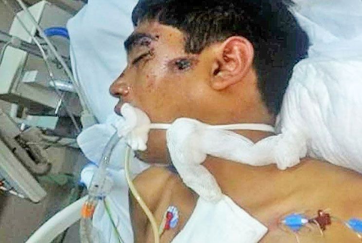 Lo detuvieron y golpearon por un robo falso: quedó en coma