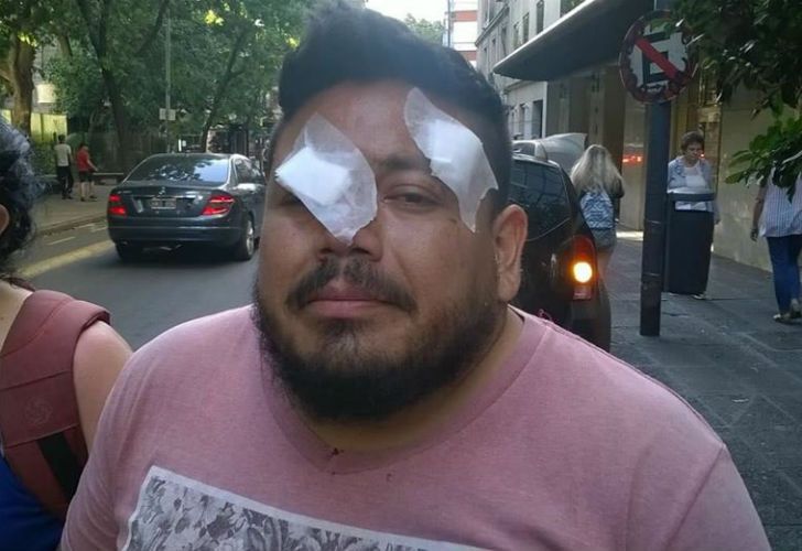 Es docente y quedó ciego de un ojo por una bala de goma en el operativo en el Congreso