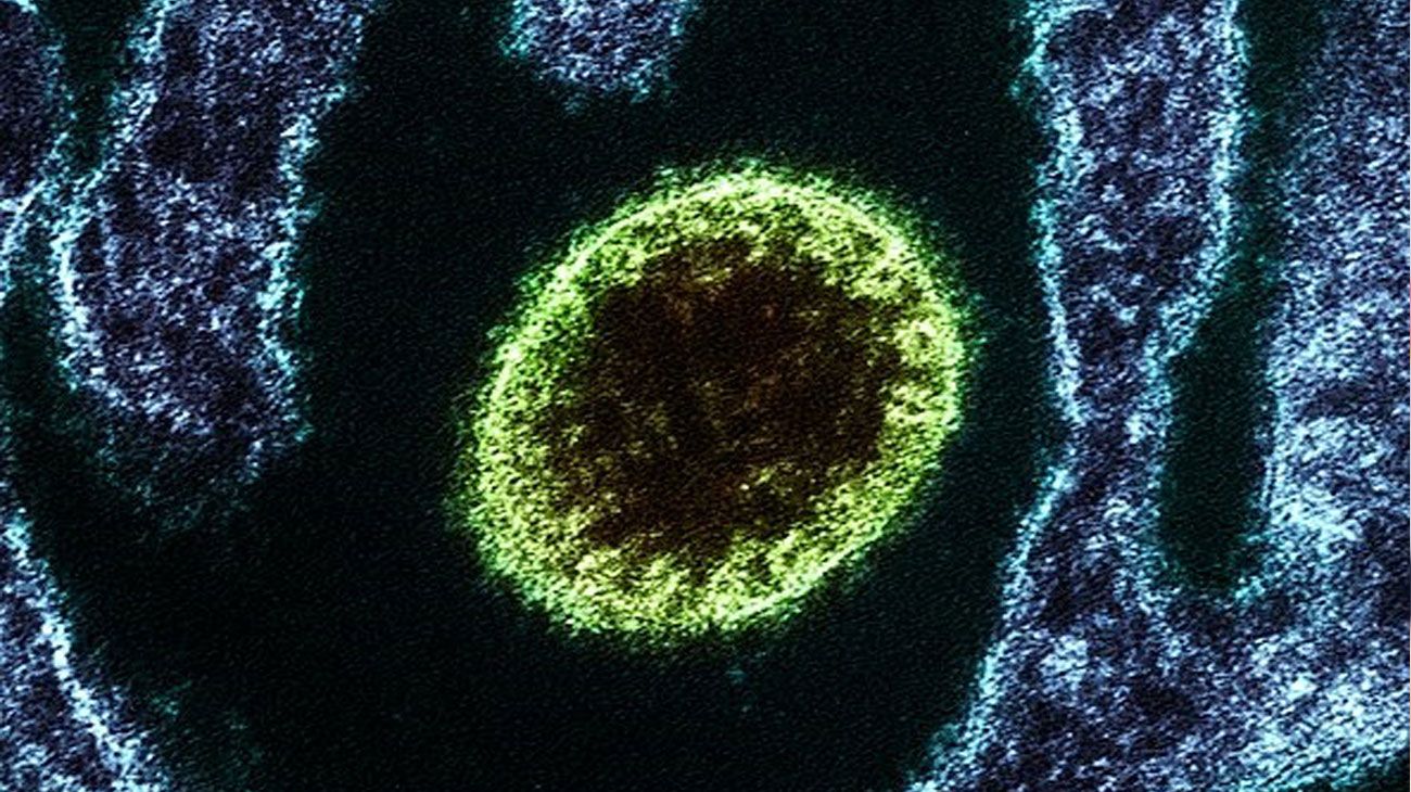 La sombra del Nipah: India contiene un brote letal mientras Asia levanta muros sanitarios