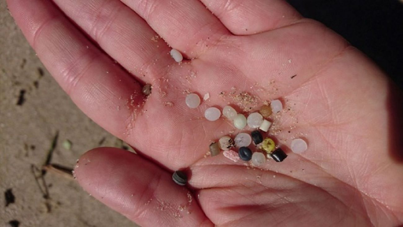 Hallan microplásticos en las venas y sugieren que podrían afectar las cirugías coronarias