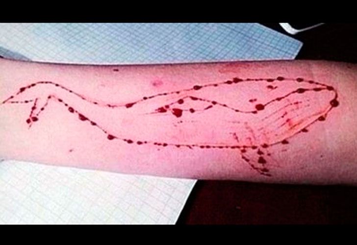 Murió un adolescente tras jugar a la Ballena Azul