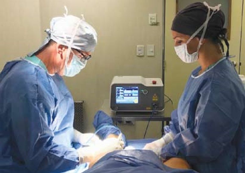 Varices: innovación láser