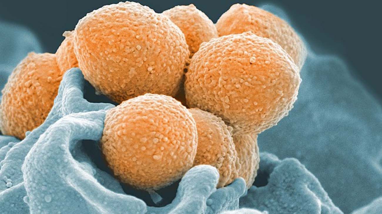 Preocupa el aumento de casos de faringitis