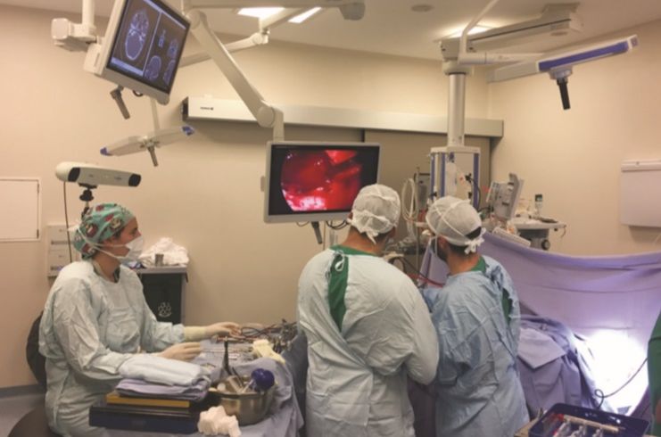 Cirugía endoscópica de base de Cráneo: un gran avance en el tratamiento de los tumores intracraneanos