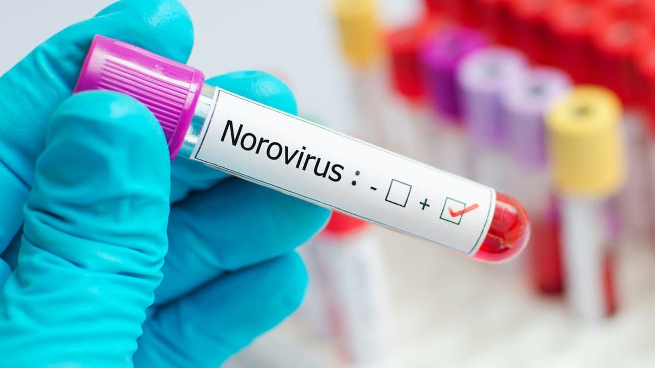 El "virus del vómito": qué es el norovirus que ahora preocupa al Reino Unido