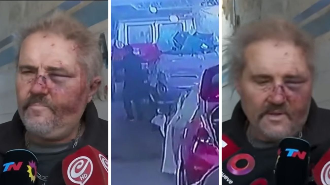 Brutal golpiza en Devoto: agredieron a un mecánico porque demoraba en entregar un vehículo
