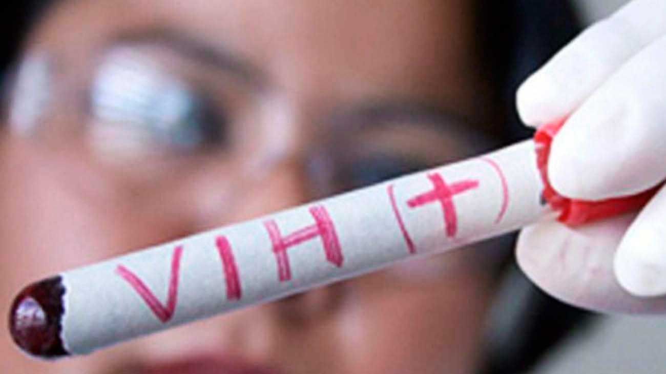 Estudian a una paciente de VIH que logró una remisión completa y dejó de medicarse
